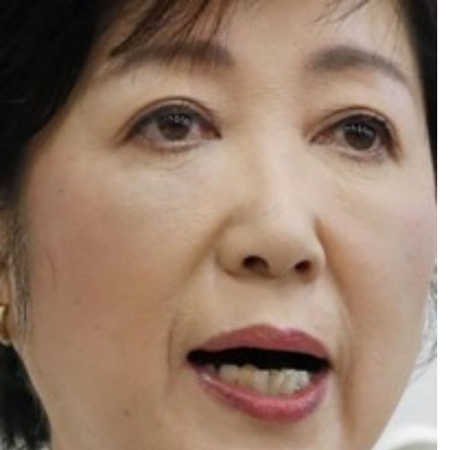 【画像】小池百合子の厚化粧はアザを隠すため！場所はどこ・いつ出来た？