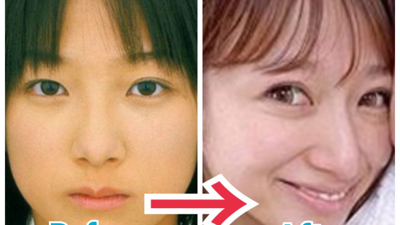 21最新 辻希美の顔が変わりすぎ 目頭切開 魔女鼻まで時系列画像